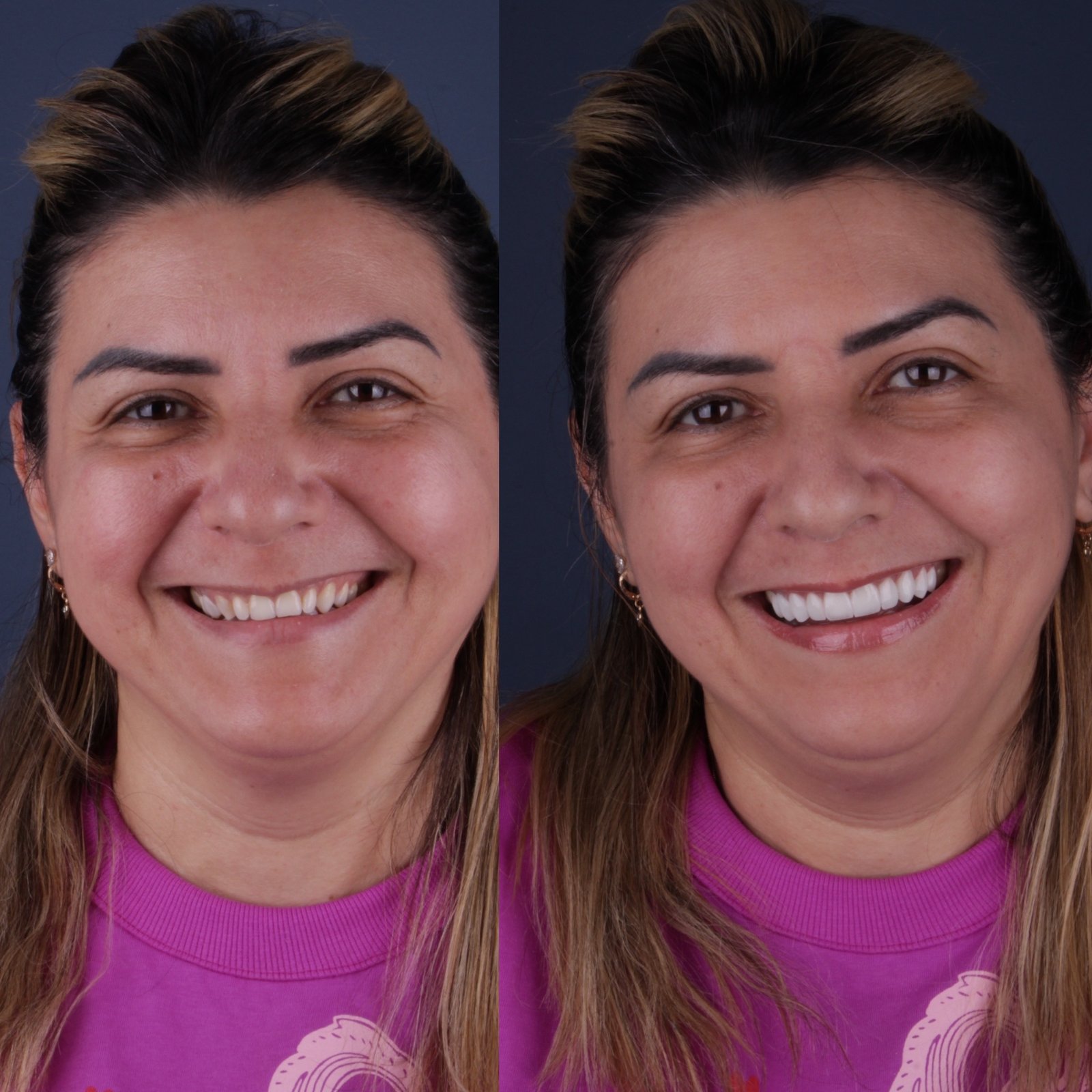 3467C6A5-6F51-4E31-95E1-900D2EFD2034