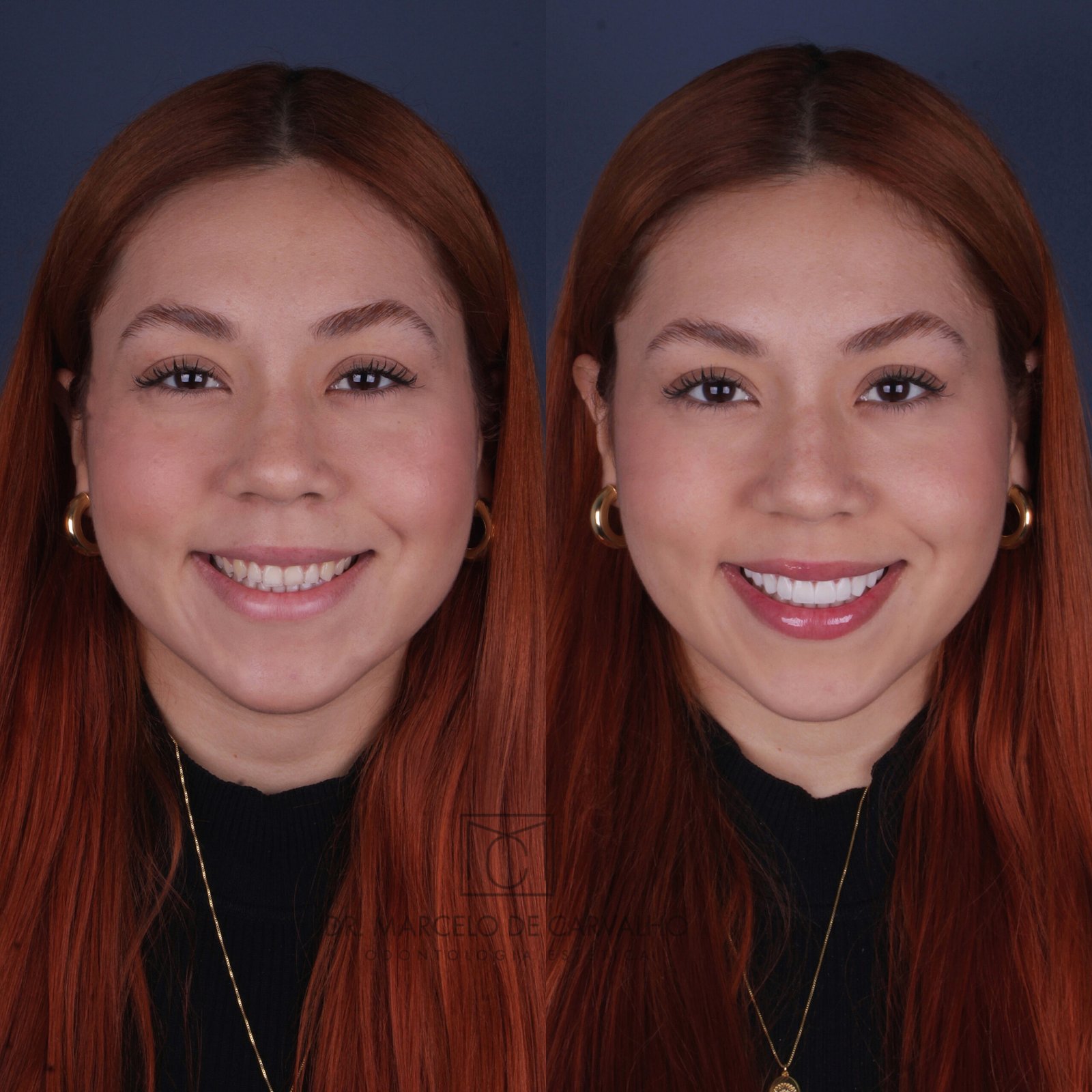 635E064F-872E-4C74-8948-37BDE7719C74