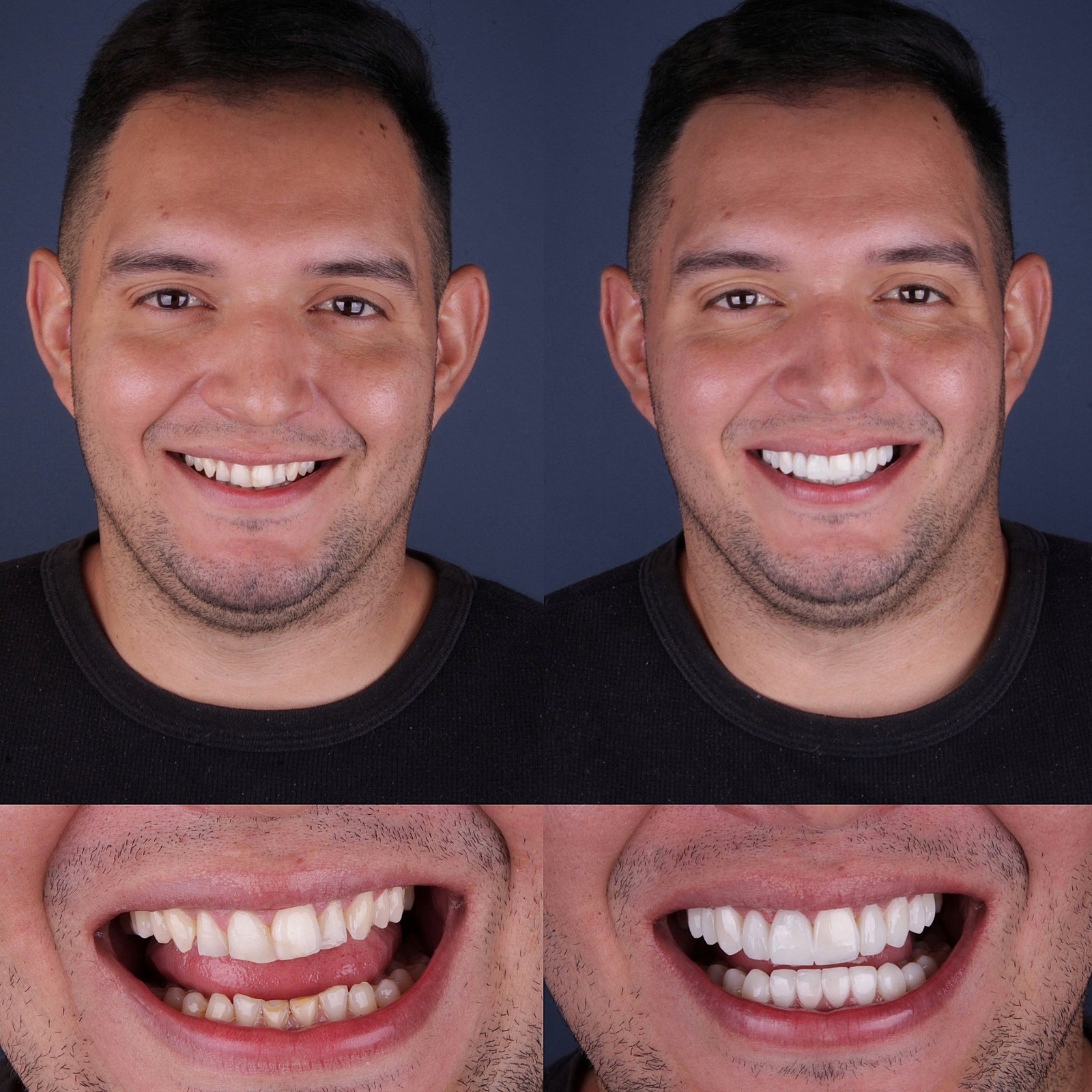 CB93CE88-0CCC-412D-8675-36C2253CD225