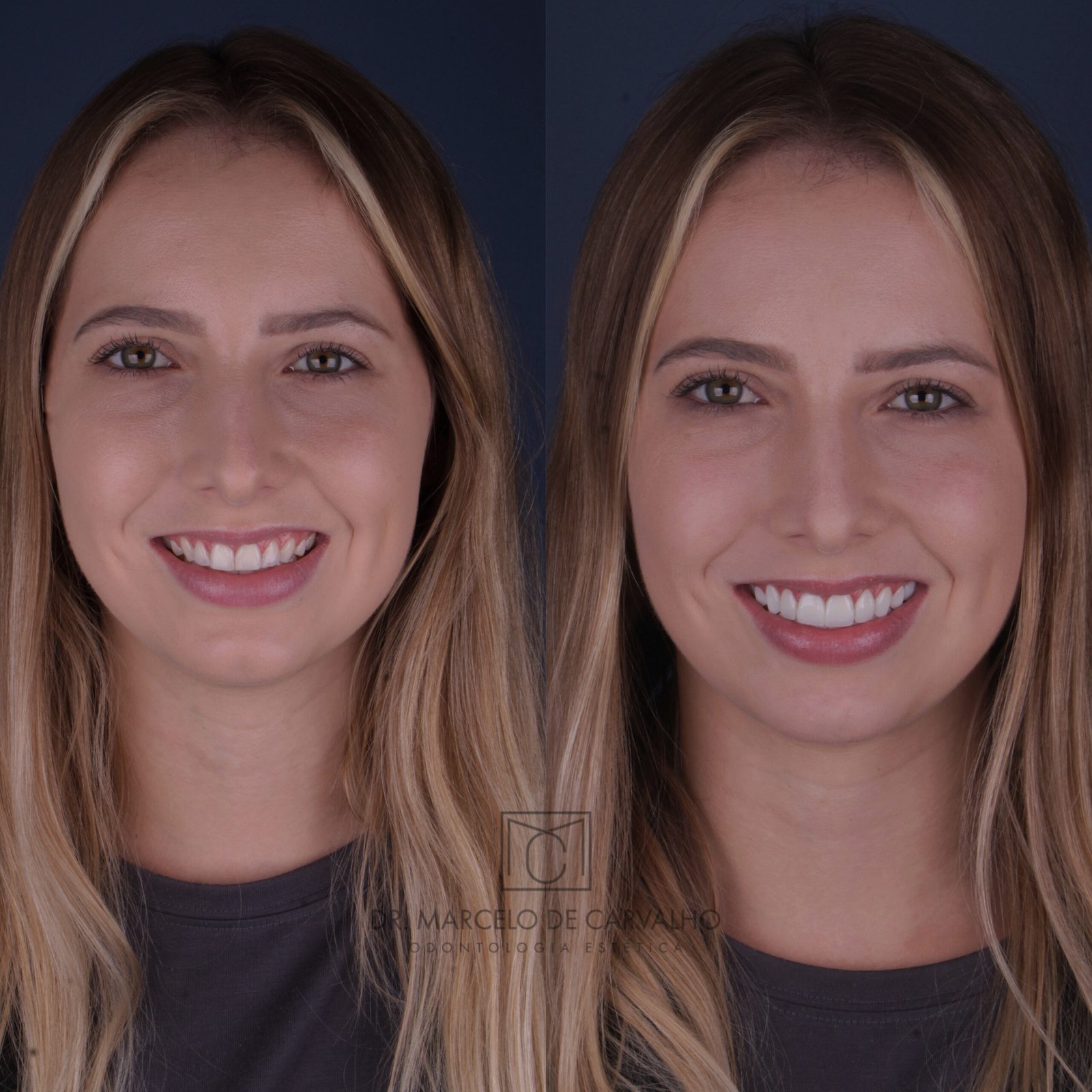 E6AD91A1-99AB-402A-B9CA-A95BB6F5CFAD